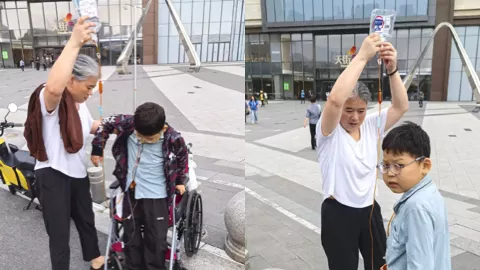 山东菏泽10岁男孩腹痛手术切除器官